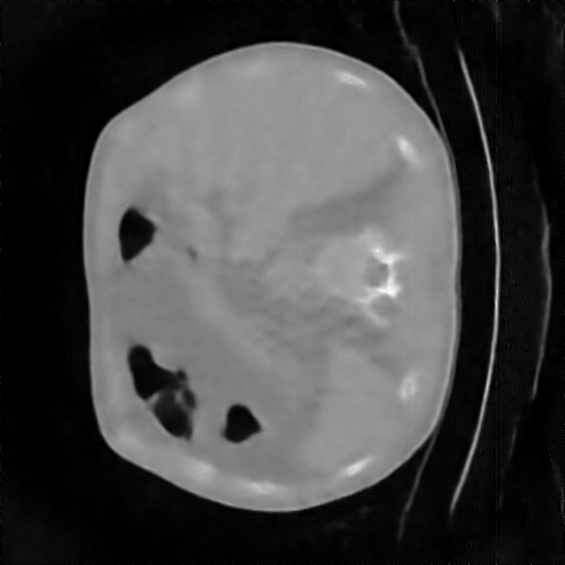 reconstructed_unet_15_99