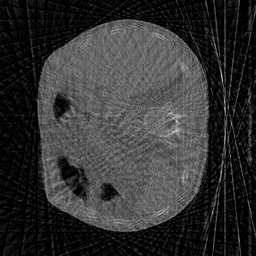 sparseview_60_test_dncnn_99
