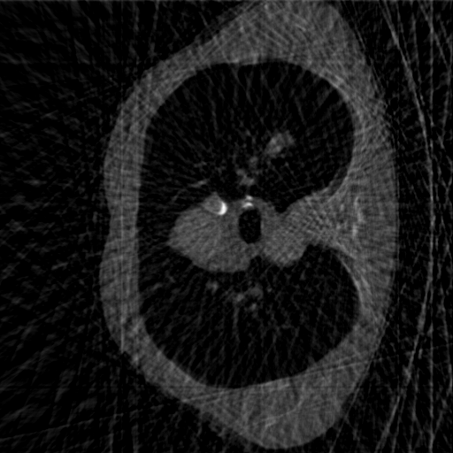 sparseview_60_test_0_sec_mod